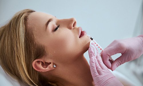dermal filler
